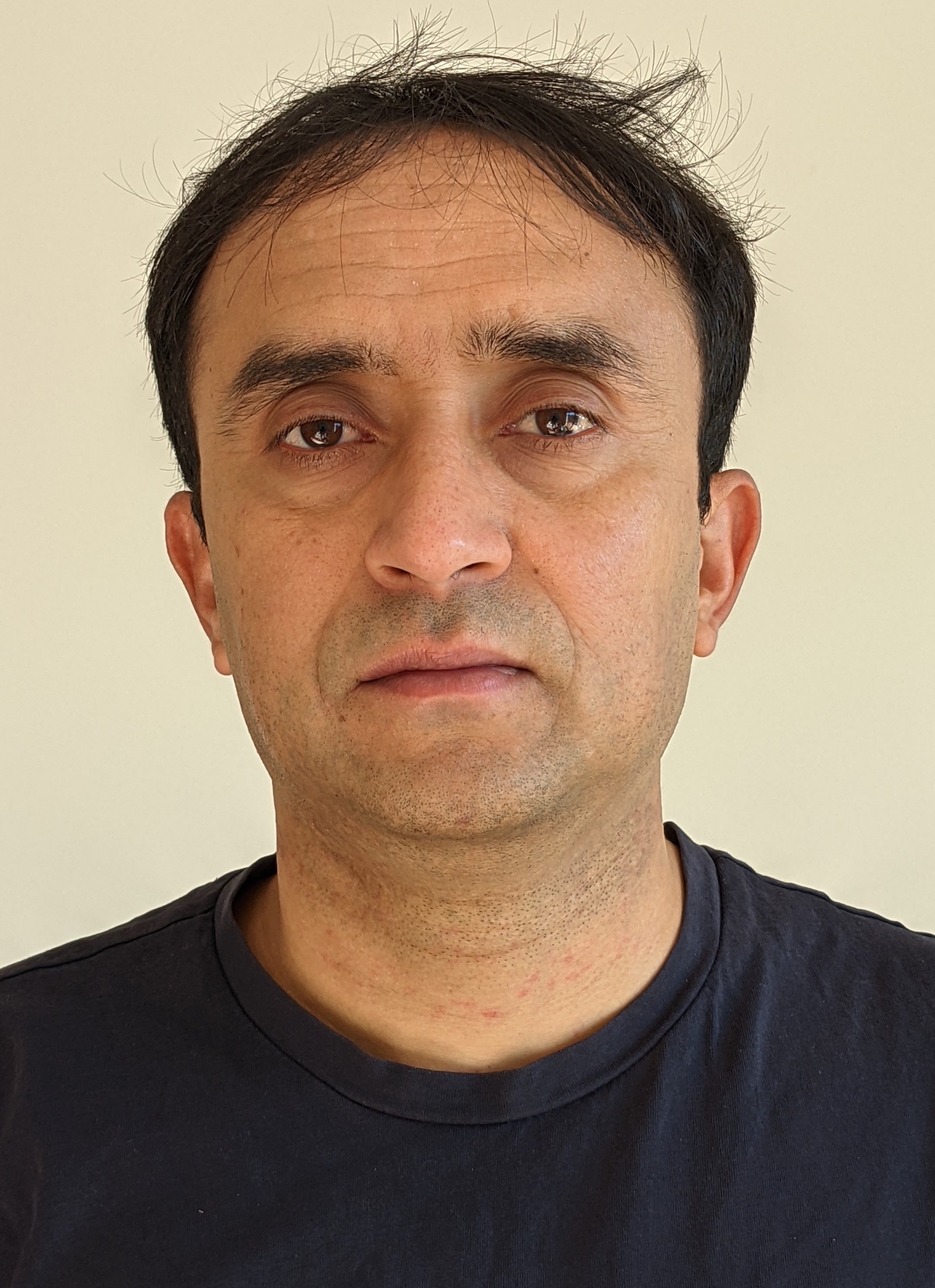 Dr. Prabal Sapkota